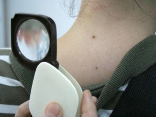 Campanie de informare despre afecţiunile dermatologice